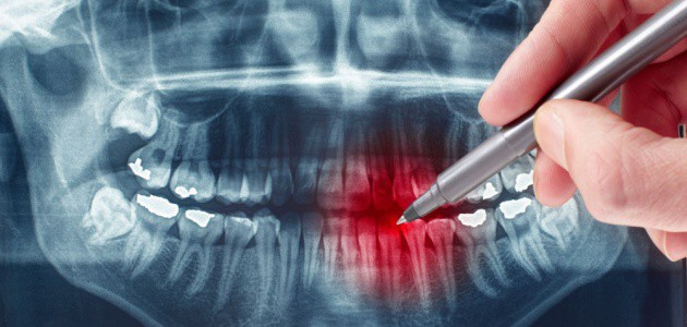 Swissdent Dentista Ica- Rx