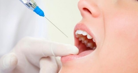 dentista ica -anestesia