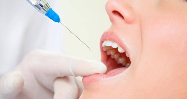 dentista ica -anestesia