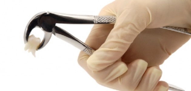 Dientes- Dentista Ica Swissdent