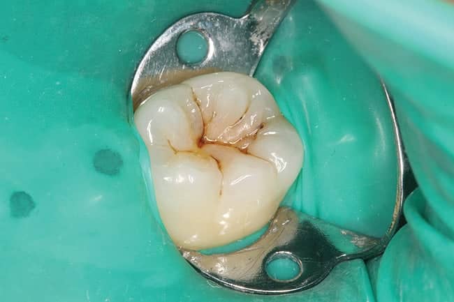 swissdent endodoncia dentista ica