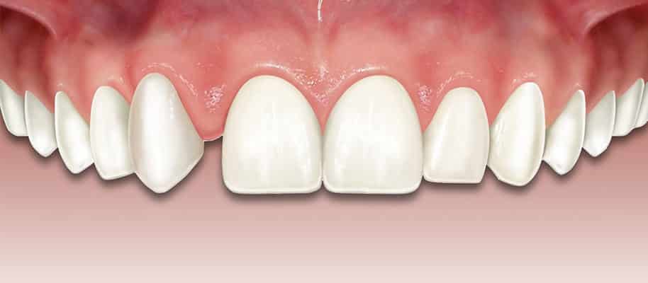 clinica dental Ica
