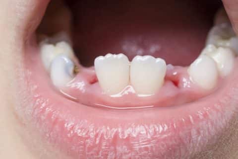 swissdent clinica dental ica