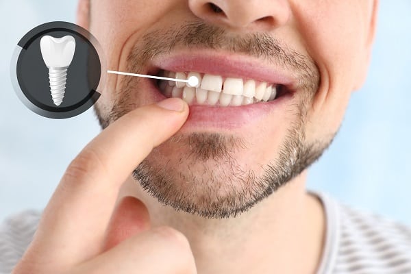 Clínica dental en Ica